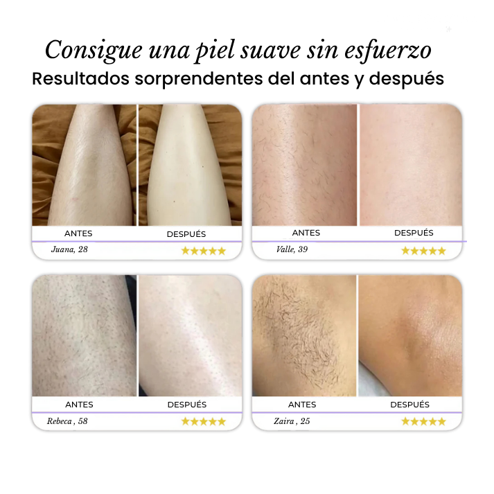 lunna™ - Depiladora 2.0